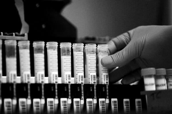 A black-and-white photograph of a series of vials filled with milk. A gloved hand holds one of the vials.